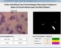 Identifikasi Fase Perkembangan Plasmodium Falciparum Dalam Sel Darah Merah Yang Terinfeksi Malaria Dengan Segmentasi Warna Adaptif Dan Klasifikasi Berbasis Pohon&nbsp;Keputusan