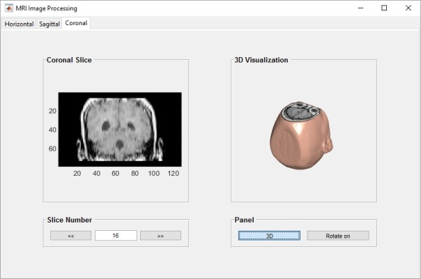 Pengolahan Citra MRI Menggunakan Matlab | Pemrograman Matlab