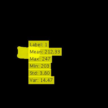 Citra Hasil Ekstraksi Ciri 1