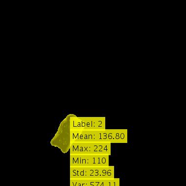 Citra Hasil Ekstraksi Ciri 2
