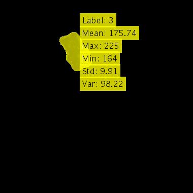 Citra Hasil Ekstraksi Ciri 3