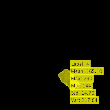 Citra Hasil Ekstraksi Ciri 4
