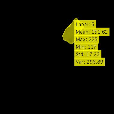 Citra Hasil Ekstraksi Ciri 5